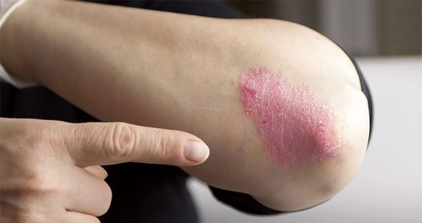 Tác dụng của mật ong rừng với sức khoẻ